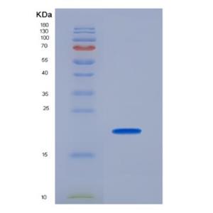 Recombinant Human Collagen Type XVII (COL17A1)