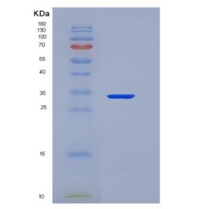 Recombinant TNF Receptor Associated Factor 6 (TRAF6)