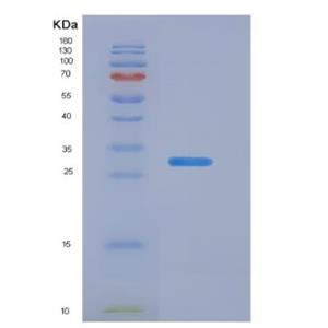 Recombinant Thyroid Hormone Receptor Beta (THRb)