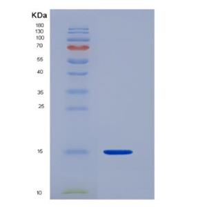 Recombinant Human Calcitonin gene-related peptide 2 Protein