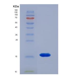 Recombinant Human FAM19A2 protein,Recombinant Human FAM19A2 protein