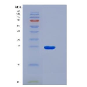 Recombinant Human Solute Carrier Family 30 Member 8 (SLC30A8) protein