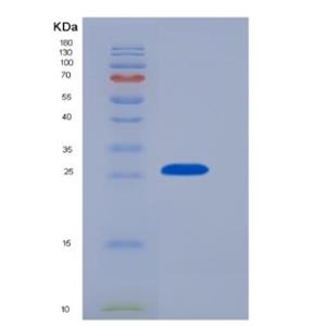 Recombinant Mouse Galectin3(GAL3)protein