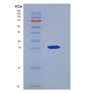 Recombinant Sigma non-opioid intracellular receptor 1 (SIGMAR1)