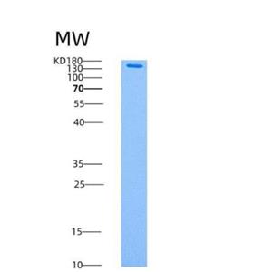 Recombinant Human AMPK (G1/B2/A2) Heterotrimer Protein