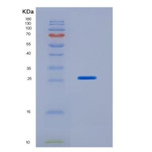 Recombinant Rat Hemopexin (HPX),Recombinant Rat Hemopexin (HPX)