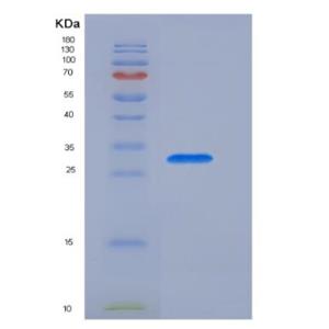 Recombinant Pulmonary Surfactant Associated Protein A1 (SFTPA1),Recombinant Pulmonary Surfactant Associated Protein A1 (SFTPA1)