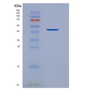 Recombinant Transforming Growth Factor Beta 1 (TGFb1)