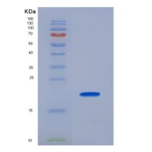 Recombinant Cytochrome C Oxidase Subunit II (COX2),Recombinant Cytochrome C Oxidase Subunit II (COX2)