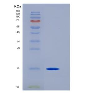 Recombinant Human Transforming Growth Factor Beta 3 (TGFb3) Protein