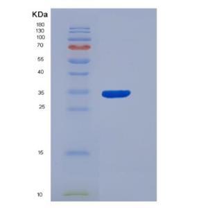 Recombinant Human Aryl Hydrocarbon Receptor (AhR) Protein