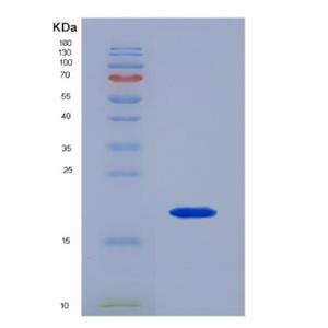 Recombinant Human SFTPD Protein