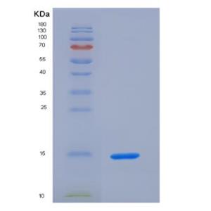 Recombinant S100 Calcium Binding Protein A9 (S100A9),Recombinant S100 Calcium Binding Protein A9 (S100A9)