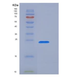 Recombinant Human Transient Receptor Potential Cation Channel Subfamily V, Member 1 (TRPV1) Protein