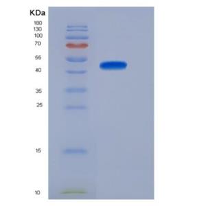 Recombinant rat FGF10 protein,Recombinant rat FGF10 protein