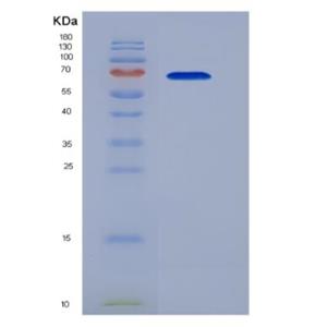 Recombinant Mouse Heat Shock 70kDa Protein 1B (HSPA1B)