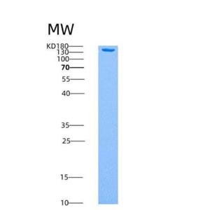 Recombinant Human AMPK (G1/B1/A2) Heterotrimer Protein,Recombinant Human AMPK (G1/B1/A2) Heterotrimer Protein