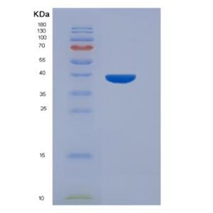 Recombinant Human Serotonin Transporter (SERT) Protein