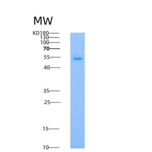 Recombinant Human DOPA Decarboxylase / DDC Protein (His tag),Recombinant Human DOPA Decarboxylase / DDC Protein (His tag)