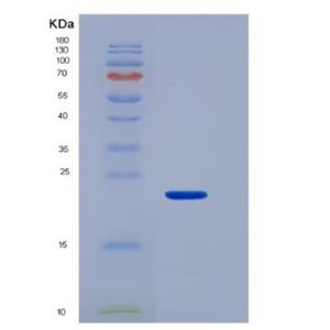 Recombinant Mucin 4 (MUC4),Recombinant Mucin 4 (MUC4)