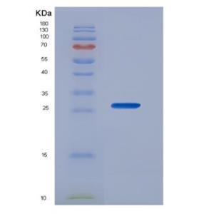 Recombinant Cyclin B (CCNB),Recombinant Cyclin B (CCNB)