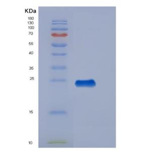 Recombinant Human Thrombomodulin (TM) Protein