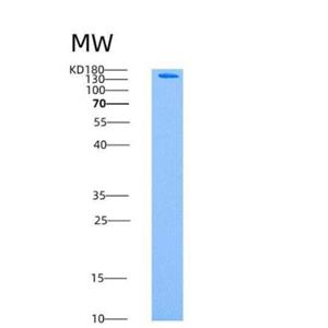 Recombinant Human AMPK (G1/B2/A1) Heterotrimer Protein,Recombinant Human AMPK (G1/B2/A1) Heterotrimer Protein