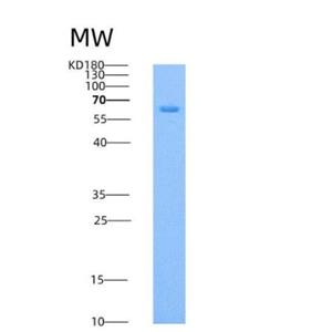 Recombinant Mouse Endoglin / CD105 / ENG Protein (His tag)