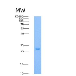 Recombinant Human respiratory syncytial virus (RSV) (A, rsb1734) glycoprotein G / RSV-G Protein (93% Homology) (His Tag)