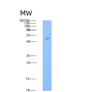 Recombinant Mouse Legumain Protein (His Tag)