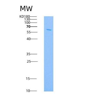 Recombinant Human IL18RAP / IL1R7 Protein (Fc tag)