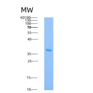 Recombinant Human PTP1B / PTPN1 Protein (His Tag)