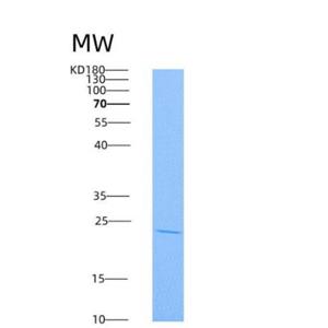 Recombinant Human RhoA Protein (His tag)