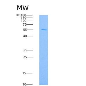 Recombinant Human DCR3 / TNFRSF6B Protein (Fc tag),Recombinant Human DCR3 / TNFRSF6B Protein (Fc tag)