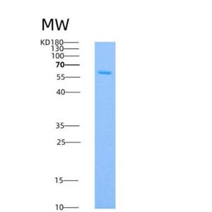 Recombinant Human SMPD1 / ASM Protein (His tag)