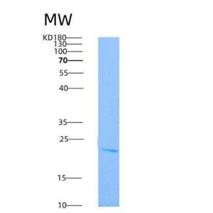 Recombinant Rat TNFRSF11A Protein (His tag),Recombinant Rat TNFRSF11A Protein (His tag)