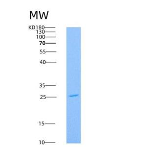 Recombinant Human AK4 / Adenylate Kinase 4 / AK3L1 Protein