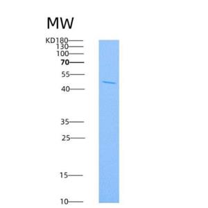 Recombinant Rat IL4R / Il4ra Protein (Fc tag)