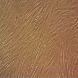 人胚肺成纤维细胞CCC-HPF-1,cells CCC-HPF-1