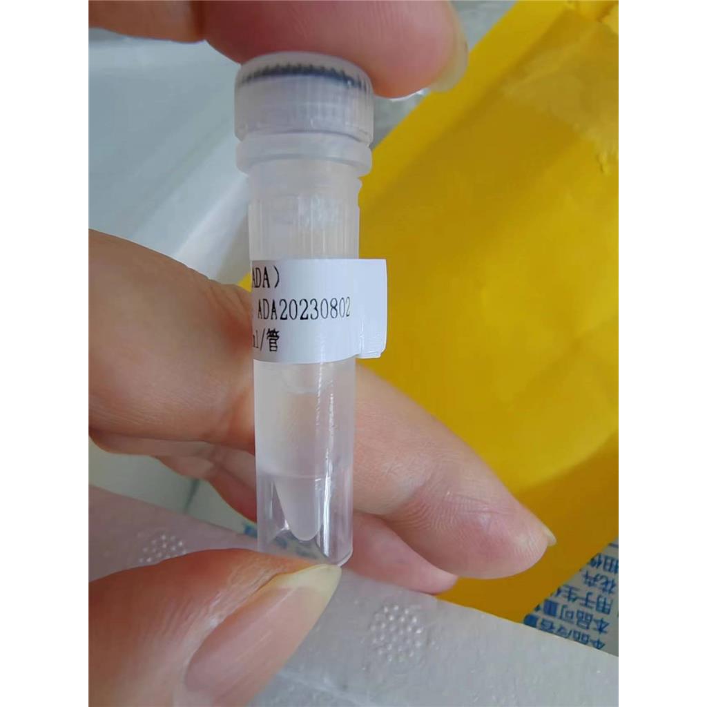 腺苷脱氨酶 (ADA) 液体  冻干粉,EC 3.5.4.4