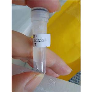 腺苷脱氨酶 (ADA) 液体  冻干粉,EC 3.5.4.4