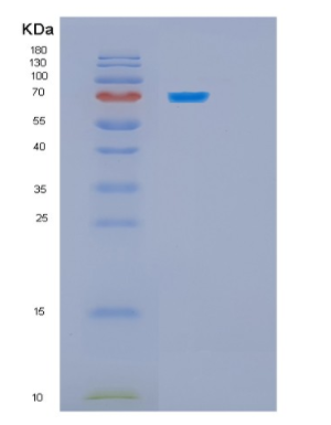 Recombinant Human HSPA5 Protein,Recombinant Human HSPA5 Protein