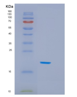 Recombinant Human HSPB6 Protein,Recombinant Human HSPB6 Protein