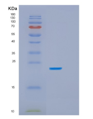 Recombinant Human HSPB8/HSP22 Protein,Recombinant Human HSPB8/HSP22 Protein