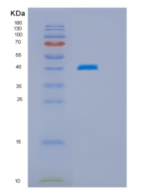 Recombinant Human HSPBP1 Protein,Recombinant Human HSPBP1 Protein