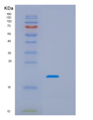 Recombinant Human HSPB3 Protein,Recombinant Human HSPB3 Protein