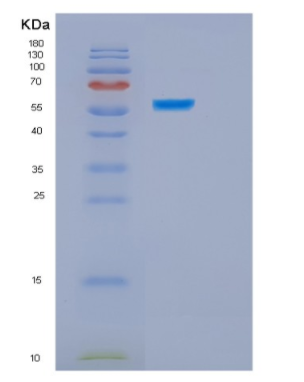 Recombinant Human HSPBAP1 Protein,Recombinant Human HSPBAP1 Protein