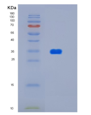 Recombinant Human HtrA2/Omi 134-458 Human Protein,Recombinant Human HtrA2/Omi 134-458 Human Protein