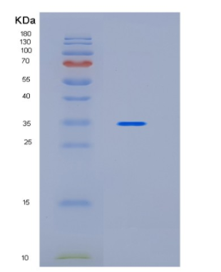 Recombinant Human IBSP Protein,Recombinant Human IBSP Protein