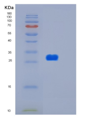 Recombinant Human HTATIP2 Protein,Recombinant Human HTATIP2 Protein